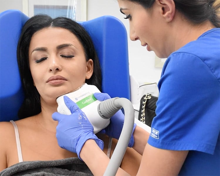 CoolSculpting beverly hills california