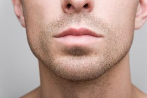 Chin Implant Surgeon Beverly Hills, CA