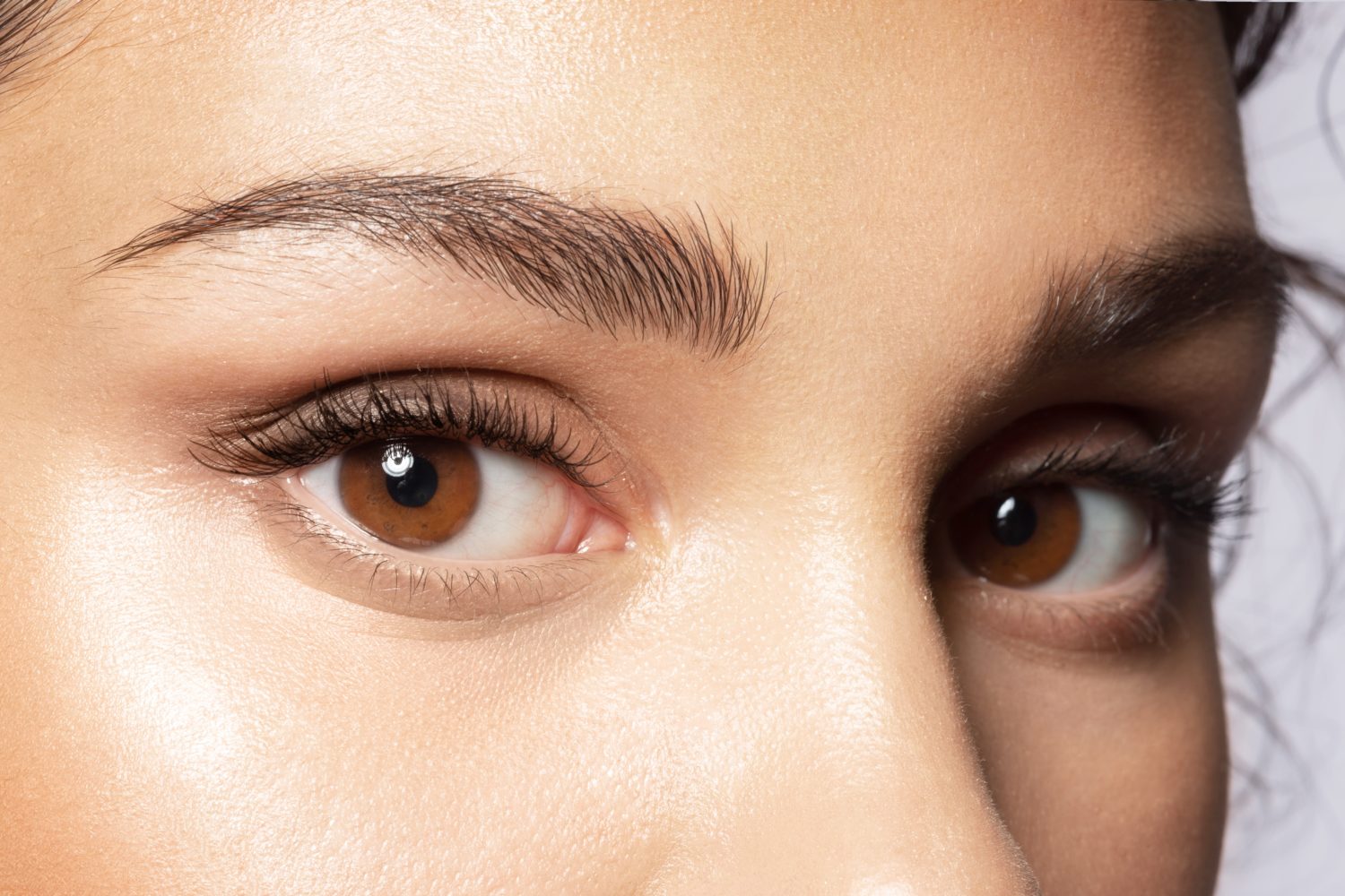 blepharoplasty eyelid surgery