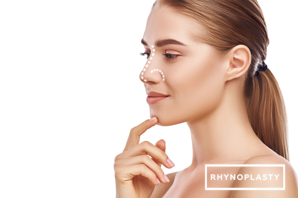 Revision rhinoplasty Beverly Hills