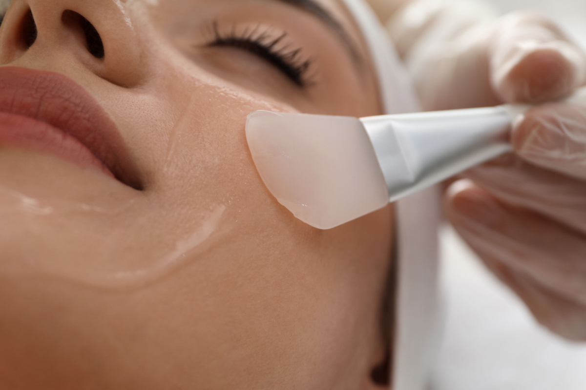 Beverly Hills chemical peel
