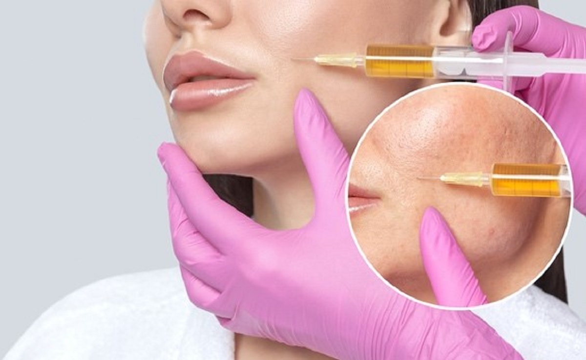 Cosmetic injectables Beverly Hills