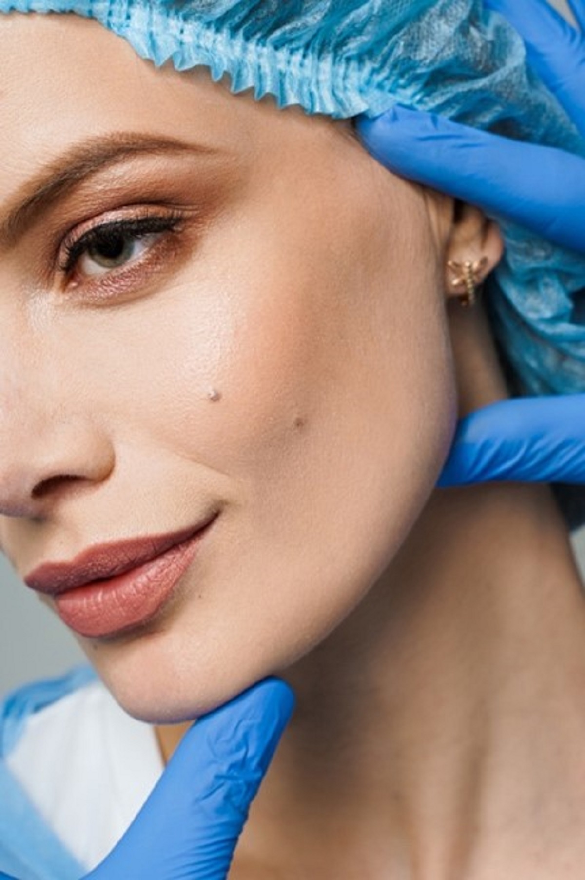 Chin augmentation Beverly Hills